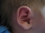 Tiny ears