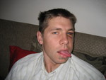 Jordan after the soccer accident (before surgery)
