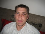 Jordan after the soccer header accident but before surgery