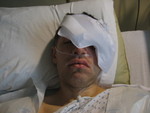 After surgery - in the hospital