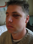 Still waiting to be discharged (Jordan couldn't open his eyes for 3 days)