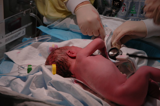 Madison after delivery